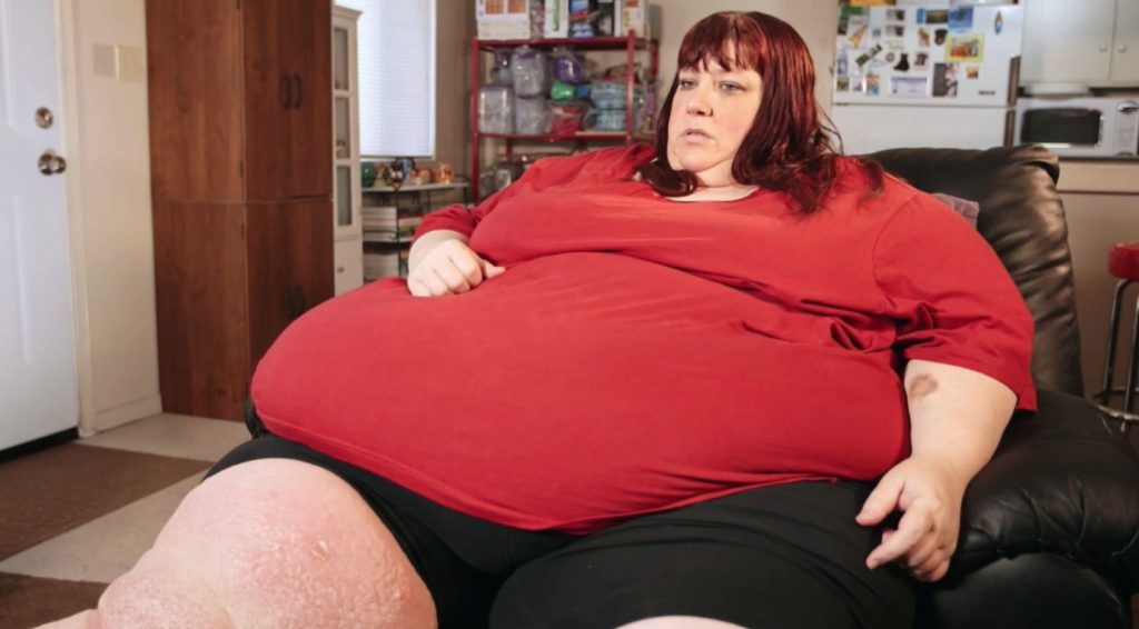 Doença da obesidade