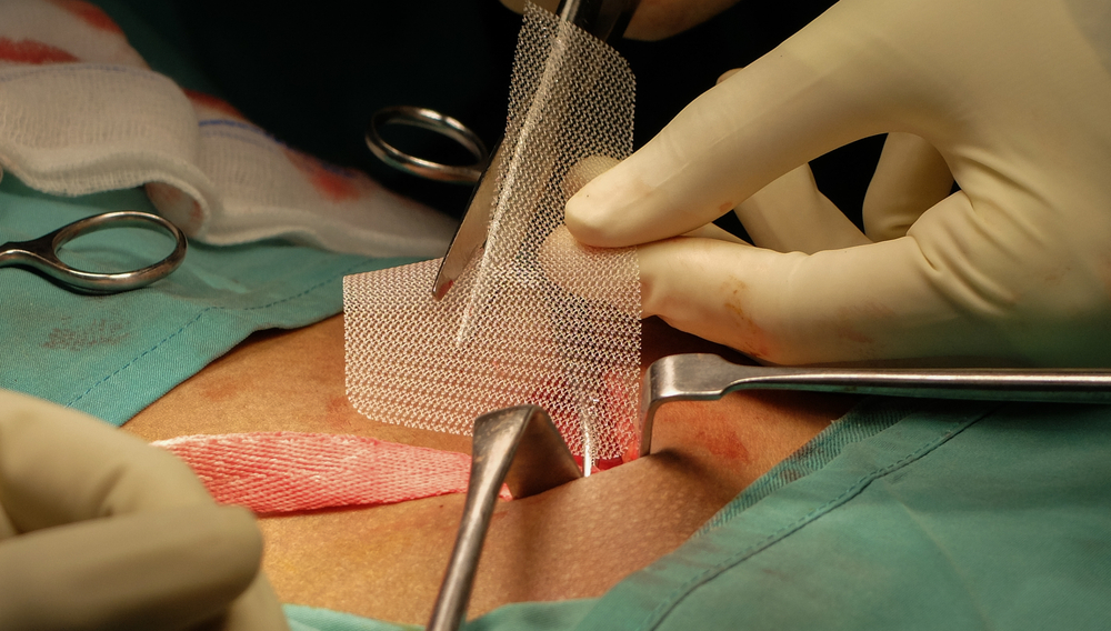 Cirurgia de Hérnia