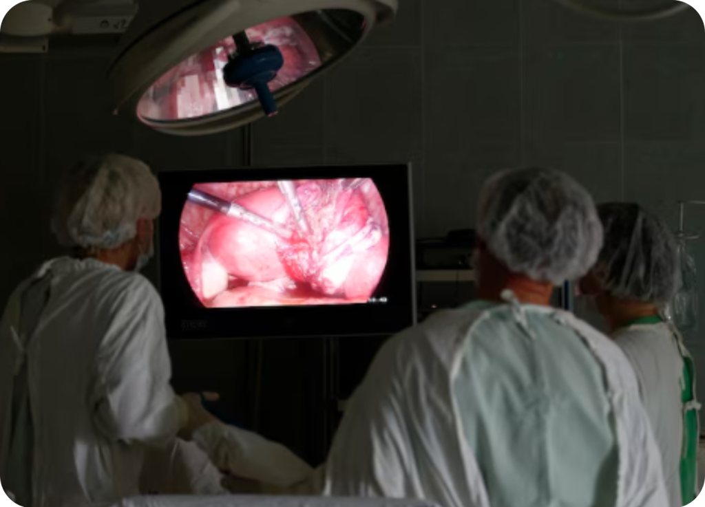 Visão da equipe médica no centro cirúrgico realizando uma cirurgia por vídeo, onde a imagem de alta definição da câmera é projetada para guiar os instrumentos.
